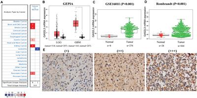 Elevated GAS2L3 Expression Correlates With Poor Prognosis in Patients With Glioma: A Study Based on Bioinformatics and Immunohistochemical Analysis